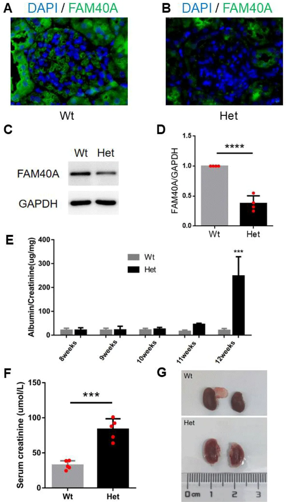 FAM40A Deficiency Activates the Hippo Pathway to Promote Podocyte Apoptosis and Contribute to FSGS