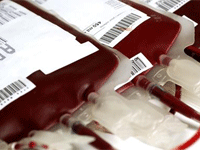 Transfusion Medicine Open Access Journals
