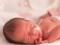 Low Birth Weight Google Scholar Articles